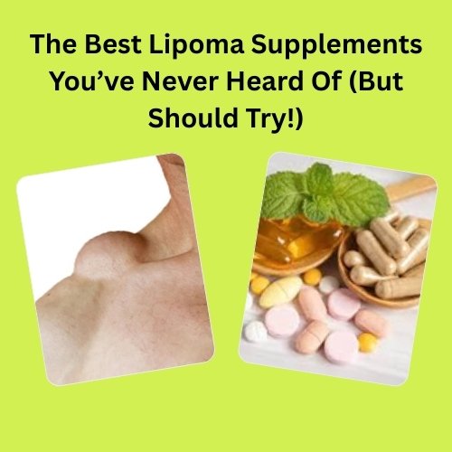 the best lipoma supplements